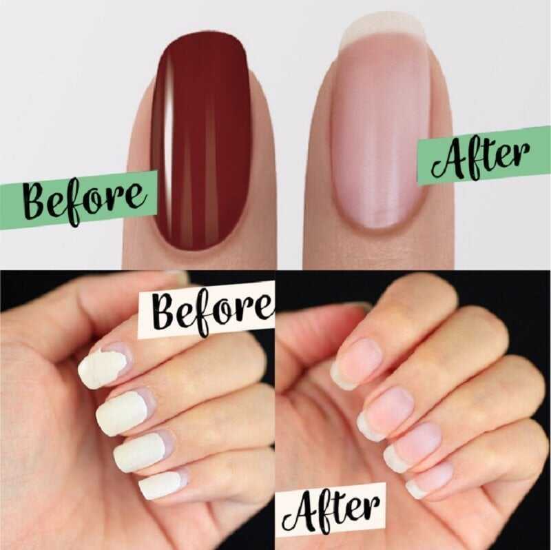 🔥HOT SALE 60% OFF🤩NEW Upgraded Magic Nail Polish Remover