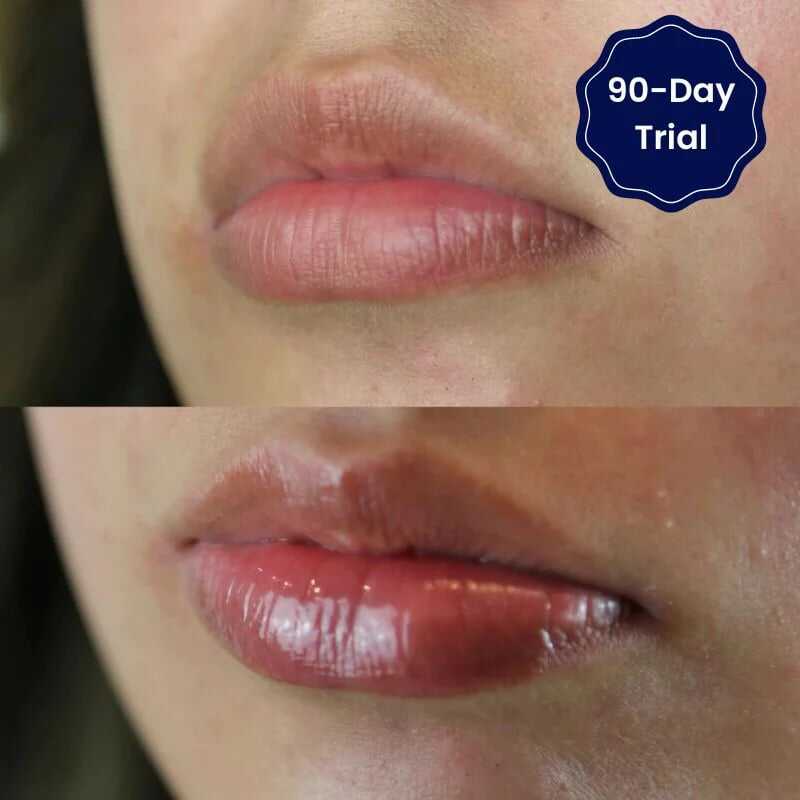 😍BIG SALE 🔥Vitamin E Lip Serum